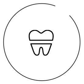 詰め物・被せ物