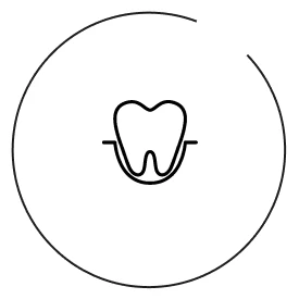 義歯（入れ歯）