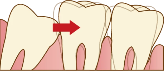 前の歯を押している
