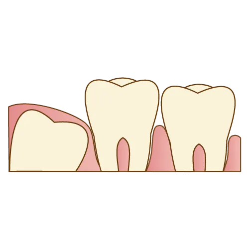 完全に埋まっている